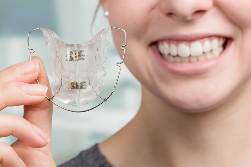 Retainers at Rebel Smiles Orthodontics