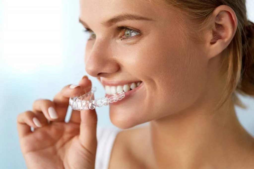 Invisalign with Rebel Smiles Orthodontics