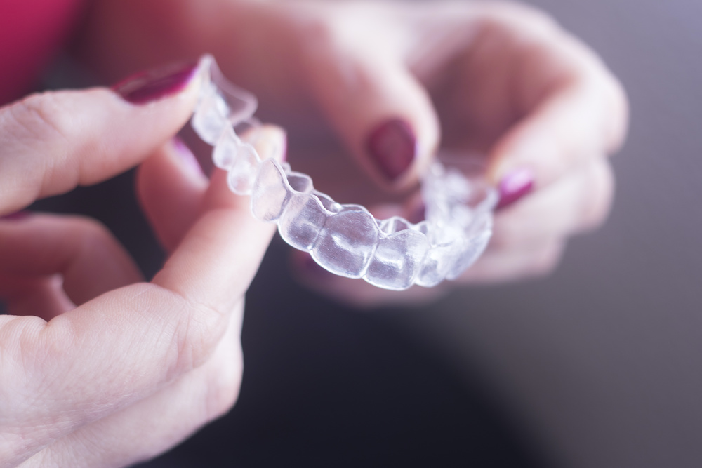 Invisalign Clear Aligners