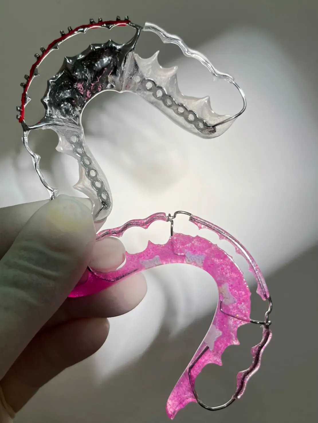 Retainers at Rebel Smiles Orthodontics